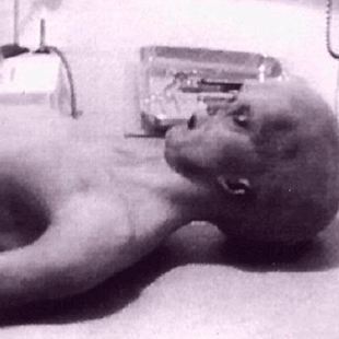 The 1947 allien autopsy video that shocked the world in 1995 was a fraud.